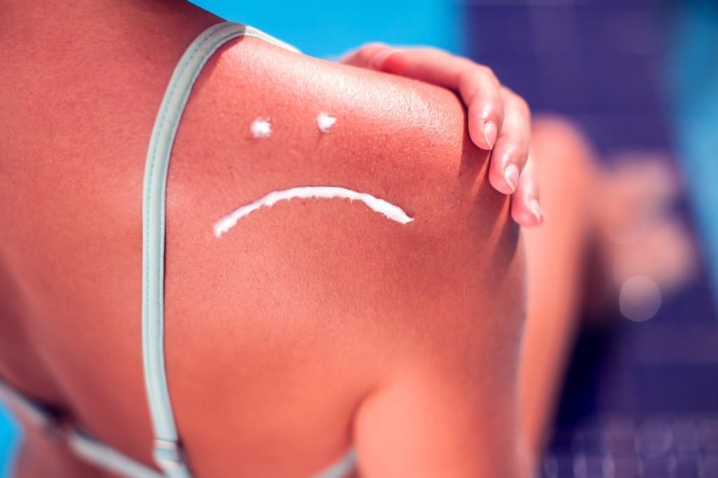 wat moet je doen als je geen aftersun hebt
