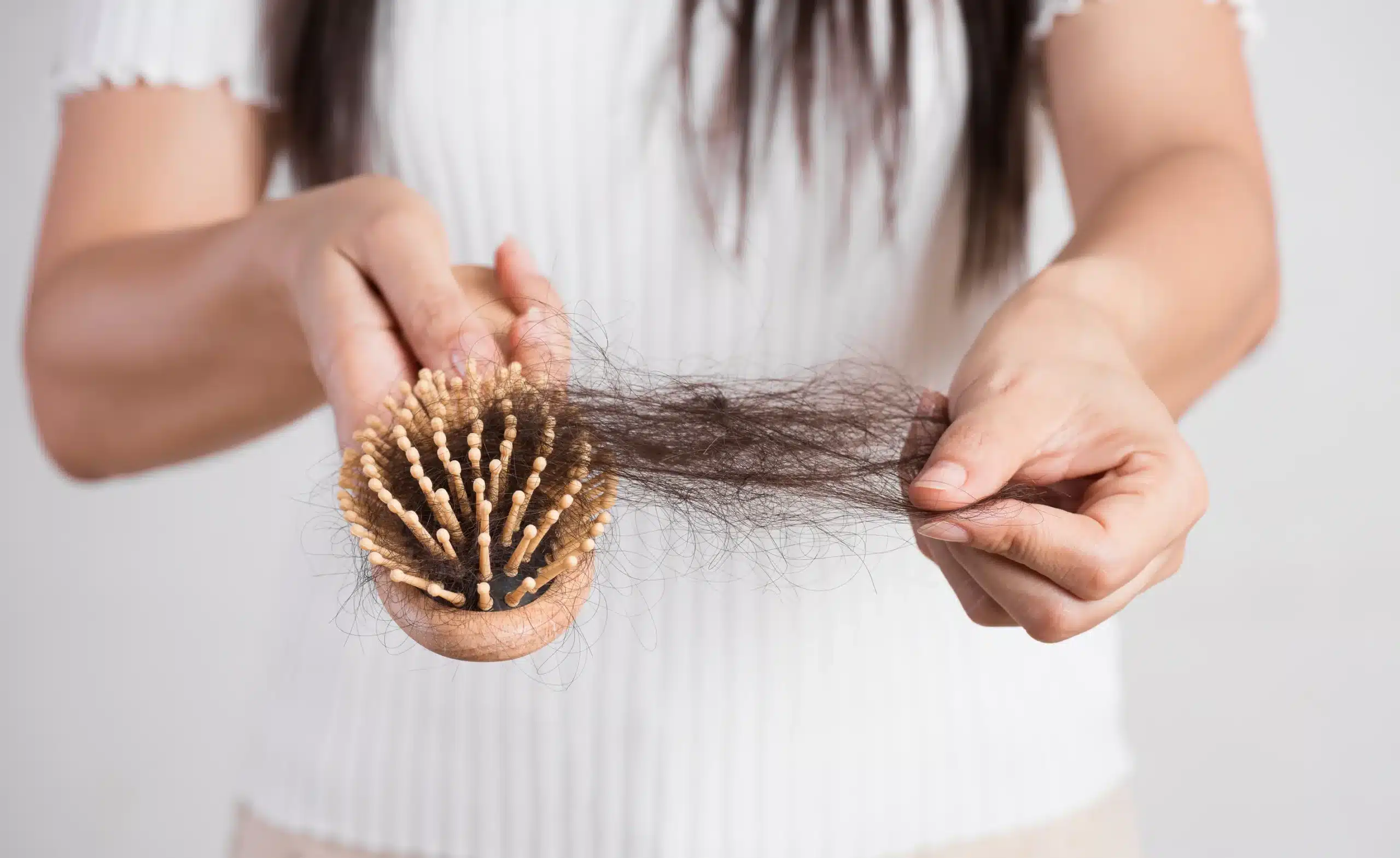 haarverlies bij vrouwen